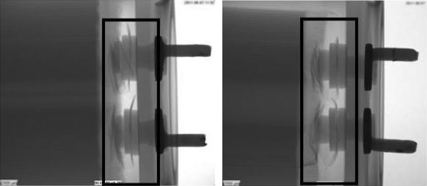 X-ray khuyết tật tụ điện